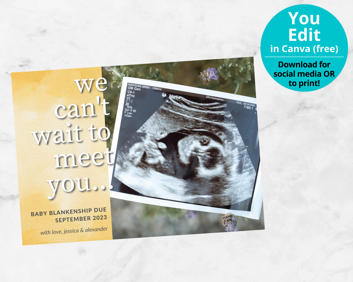 Editable, Printable Pregnancy Announcement Card (Sonogram Template