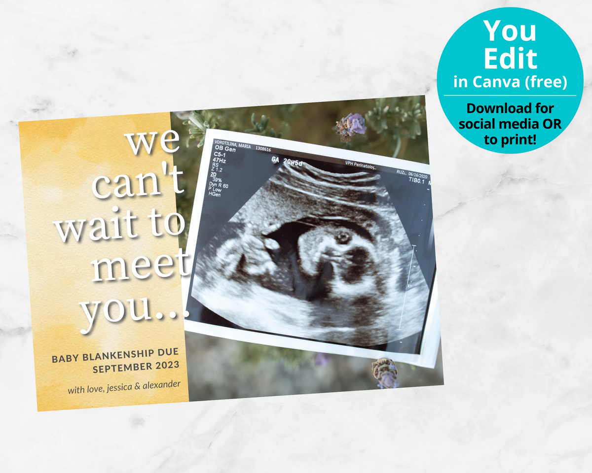 Editable, Printable Pregnancy Announcement Card (Sonogram Template Editable, Printable Pregnancy Announcement Card (Sonogram Template